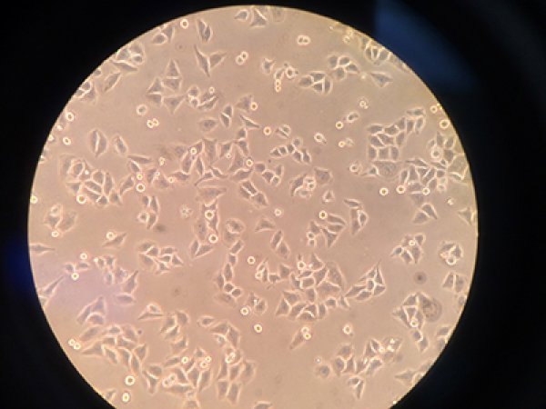 HeLa cells under microscope