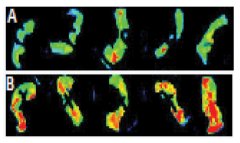 images of mouse colons with red showing how Ora-Curcumin S binds to sores or ulcers